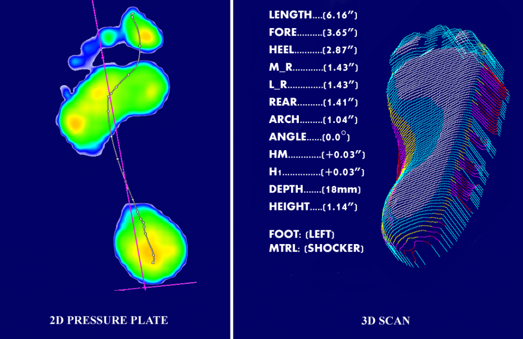 Bells And Whistles Insoles Or Custom Foot Orthotics? Foot